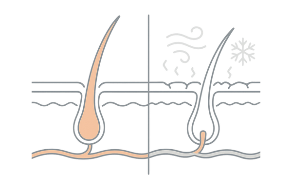 冬の乾燥で頭皮のバリア機能が低下し抜け毛リスクが高まるメカニズム図