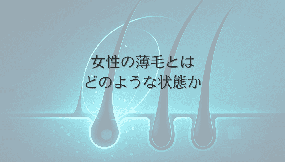 女性の薄毛とはどのような状態か - 症状の特徴と診断基準
