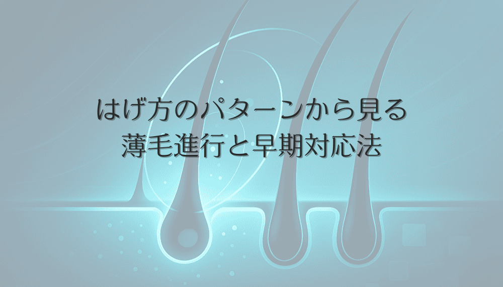 はげ方のパターンから見る女性の薄毛進行と早期対応法