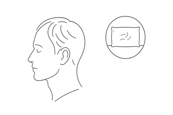 AGA初期症状の視覚サイン（ボリューム低下・枕の抜け毛イメージ）