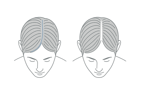 髪のハリ・コシ低下と地肌の透け感（濡れた状態の比較）