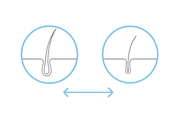 抜け毛の質チェック：毛の太さ・長さ・毛根形状の比較