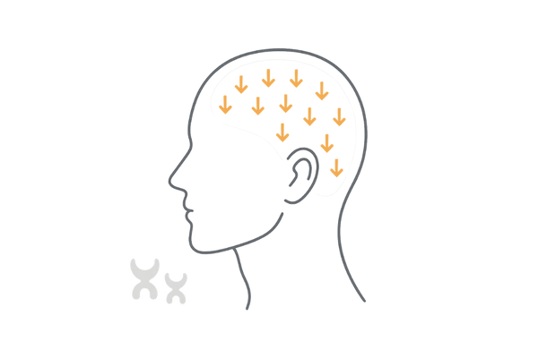 デュタステリドは“特効薬”ではない—広くDHTを下げるイメージ