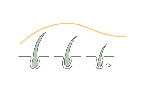 AGA進行とヘアサイクルの時間軸（年代で方針を分ける理由）