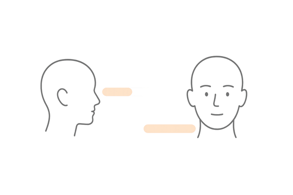 部位別の治療反応性｜前頭部は緩やか・頭頂部は早い傾向