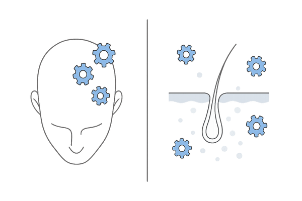 5αリダクターゼI型・II型の分布イメージ(頭皮・皮脂腺)