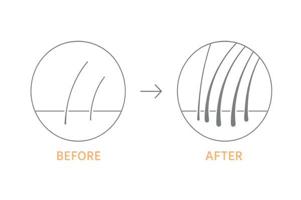 デュタステリドの臨床効果イメージ(毛髪数増加・毛髪径の改善)