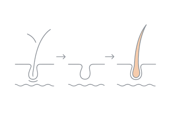 初期脱毛の経過イメージ(開始〜安定化〜発毛)