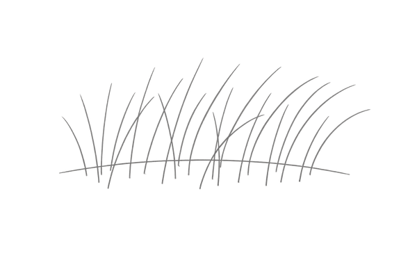 自然な生え際と分け目を再現する技術（人工皮膚スキン・ランダム植毛）