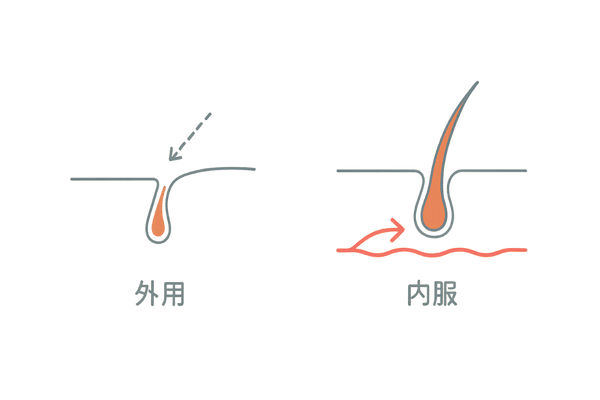 内服優位の到達イメージ｜M字部位での外用vs内服の経路差